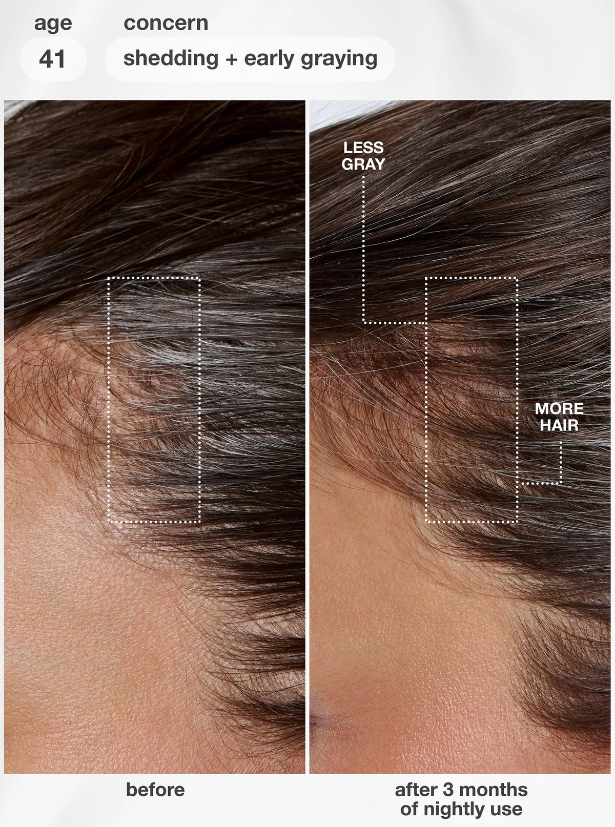 K18 Future IQ Biometic Hair Longevity Serum
