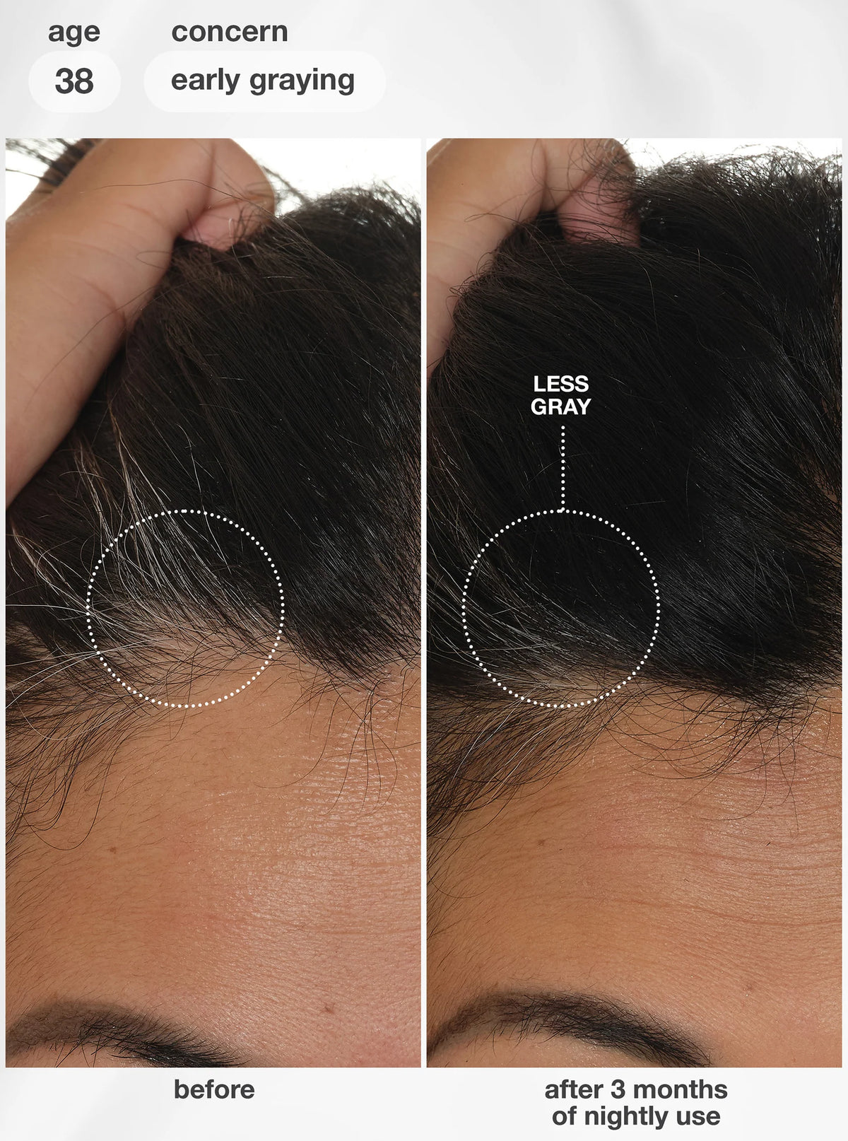 K18 Future IQ Biometic Hair Longevity Serum