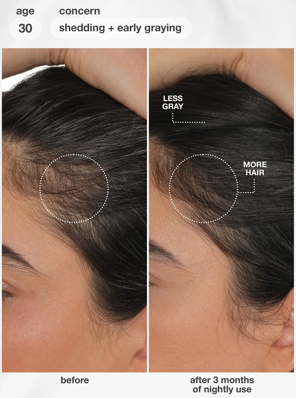 K18 Future IQ Biometic Hair Longevity Serum