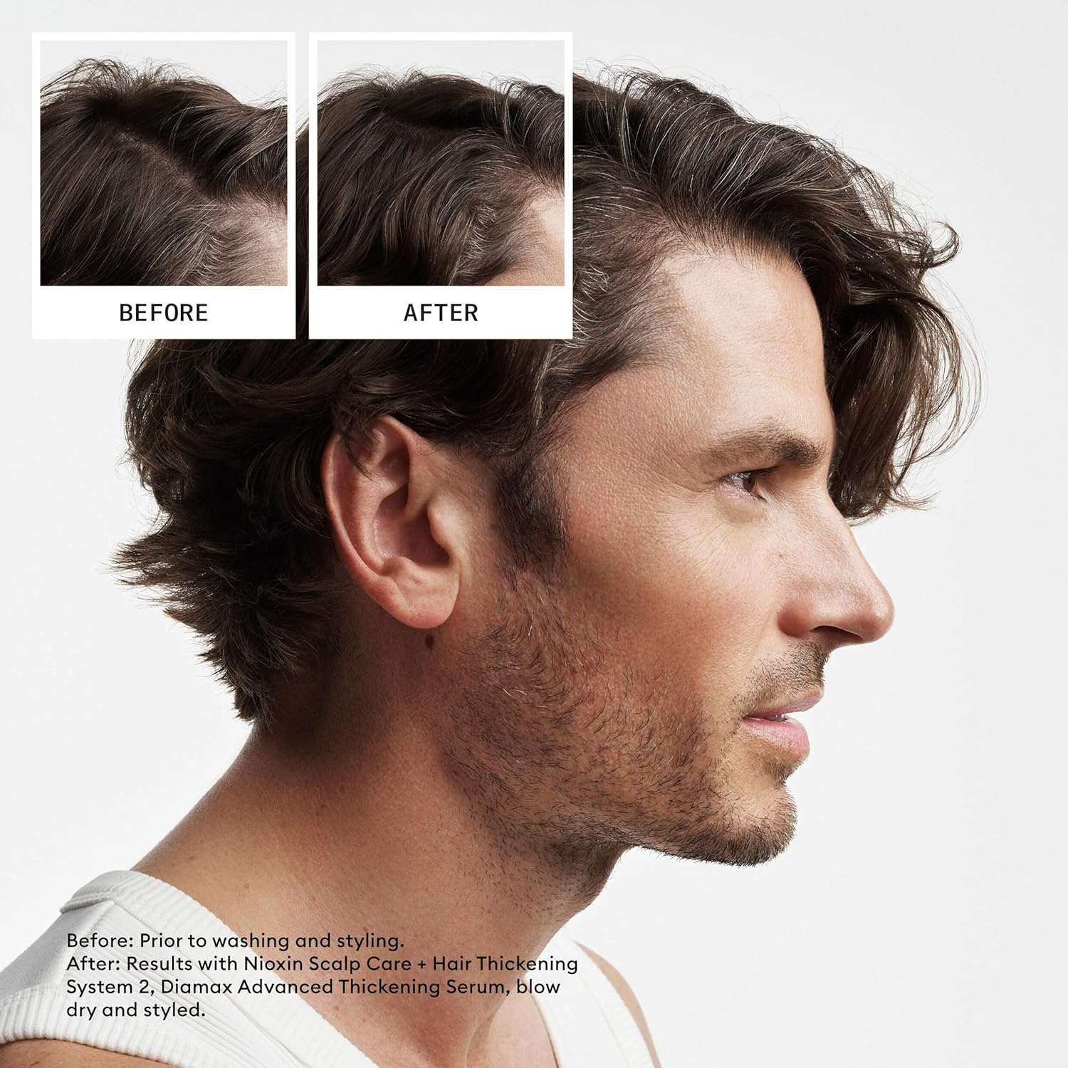 NIOXIN Scalp + Hair Shampoo Natural Untreated Hair 2